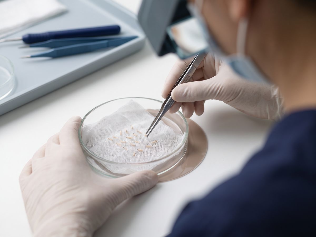 Innesti follicolari maneggiati con delicatezza